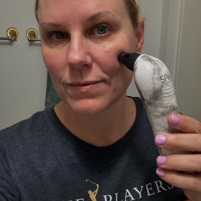 user image by @geekmamasblog, Spa Sciences BELLA 3-in-1 Diamond Tip Microdermabrasion System, with Nano Mist &#38; Pore Extraction